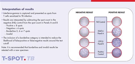 t spot blood test bottle|t spot test results.